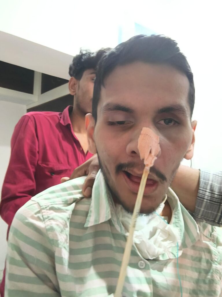 Brain Injury Patient in Jaipur