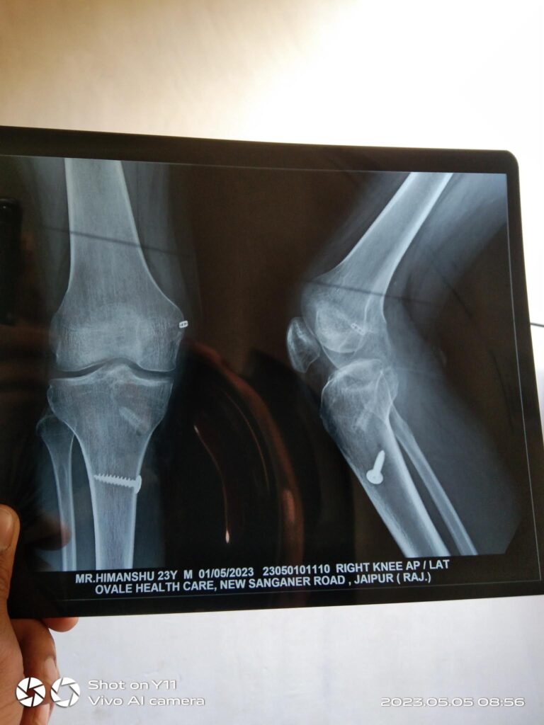 knee x-ray